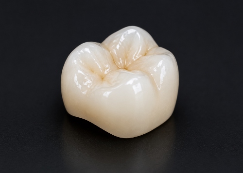 Blessed Smile- Cosmetic Dentistry- Dental Crowns